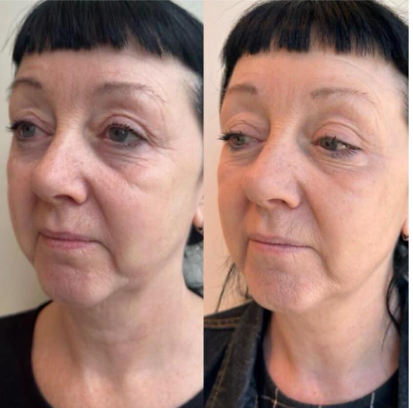 Aesthetics Clinic Melbourne - BLC Aesthetics
