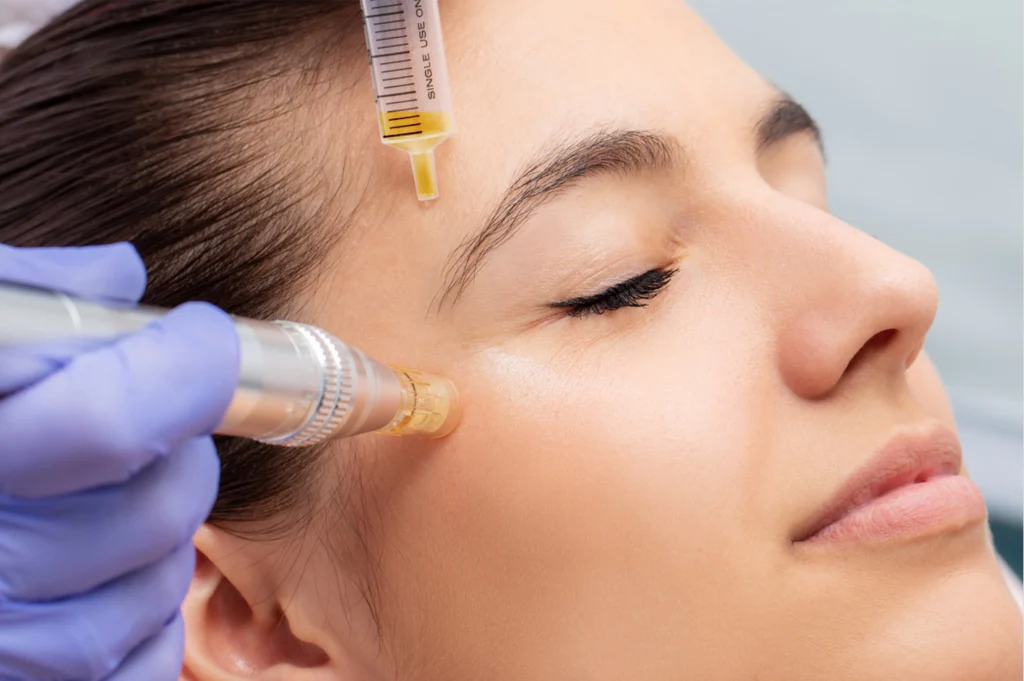 PRP at Aesthetics Clinic Melbourne - BLC Aesthetics